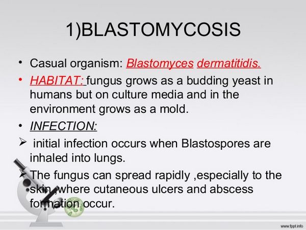 Ketoconazole Blastomycosis