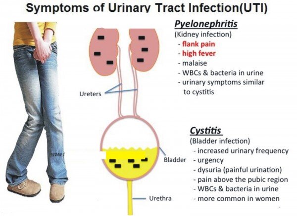 Symptoms of urinary tract infection