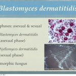 Blastomyces dermatitidis