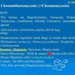 Chromoblastomycosis