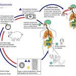 Cysticercus Cellulosea Infection