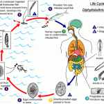Diphyllobothrium Latum Infection