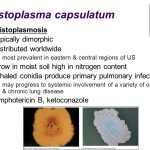 Histoplasmosis