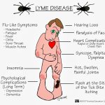 Lyme disease