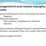Management of acute invasive aspergillus sinusitis