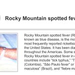 Rocky mountain spotted fever