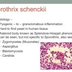 Sporothrix Schenckii