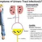 Symptoms of uti