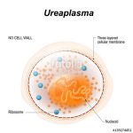 Ureaplasma