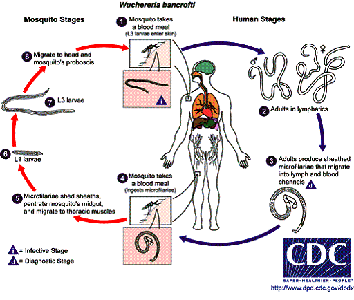 Filariasis (Wuchereria Bancrofti And Brugia Malayi) 