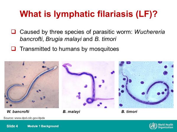 Filariasis (Wuchereria Bancrofti And Brugia Malayi) Filariasis (Wuchereria Bancrofti And Brugia Malayi)