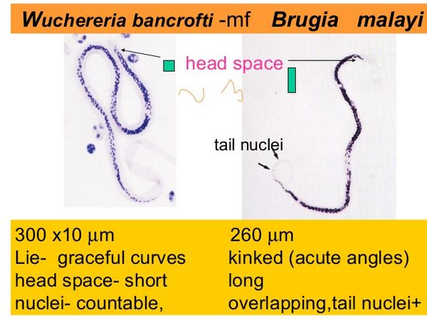 Filariasis (Wuchereria Bancrofti And Brugia Malayi) 