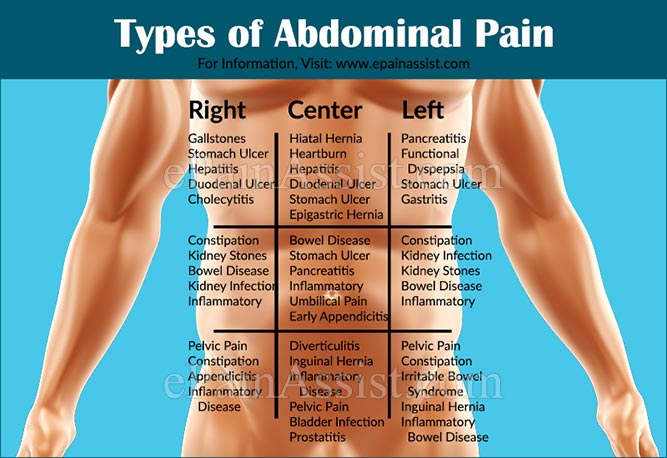 Abdominal pain 