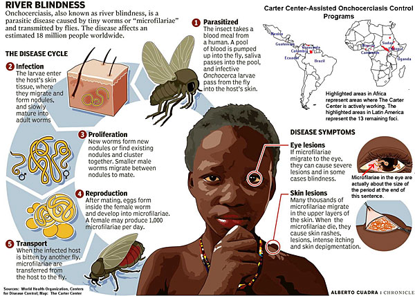 Onchocerciasis