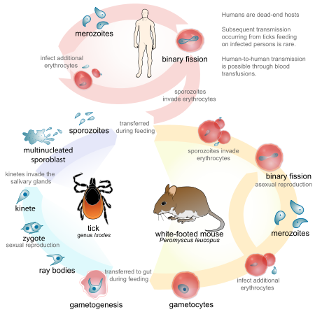 Babesiosis