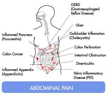 Abdominal pain 