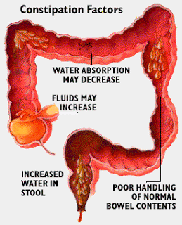  Diarrhea 