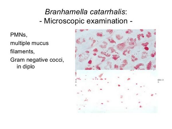 Branhamella Catarrhalis Branhamella Catarrhalis