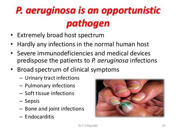 P aeruginosa infection P aeruginosa infection
