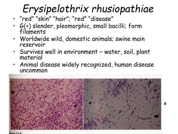 ERYSIPELOTHRIX RHUSIOPATHIAE