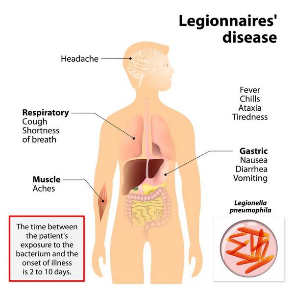 Legionella: Clinical Syndromes Legionella: Clinical Syndromes