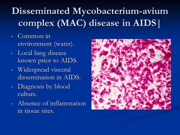 Mycobacterium Avium Complex (Disseminated & Pulmonary Disease) Mycobacterium Avium Complex (Disseminated & Pulmonary Disease)