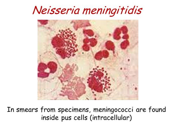 Neisseria Meningitidis