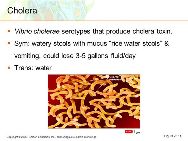 Noncholera gastroenteritis Noncholera gastroenteritis
