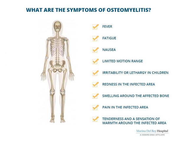 Osteomyelitis