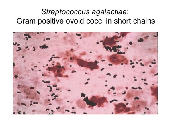 S AGALACTIAE