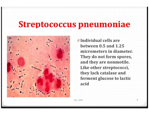 S pneumoniae