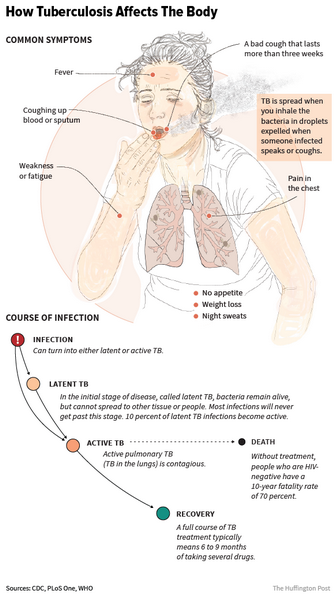 Active Tuberculosis Active Tuberculosis