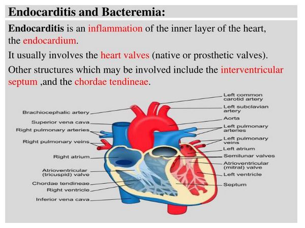 BACTEREMIA & ENDOCARDITIS