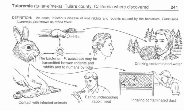 Tularemia