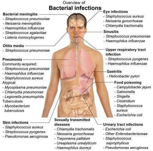 Bacterial Infections