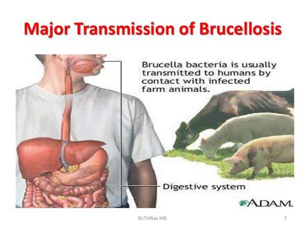 Brucellosis