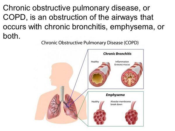 Chronic Obstructive Pulmonary Disease & Emphysema