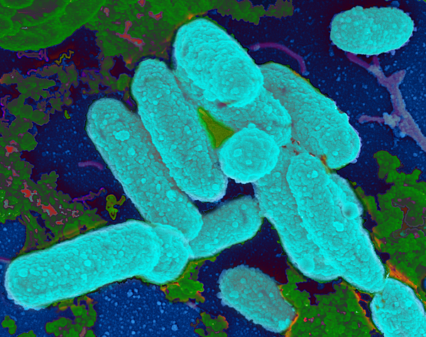 Haemophilus Influenzae