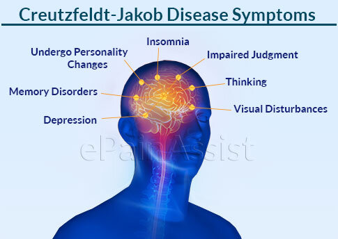 Creutzfeldt-Jakob Disease