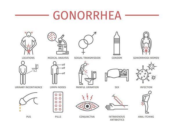 Gonorrhea Gonorrhea