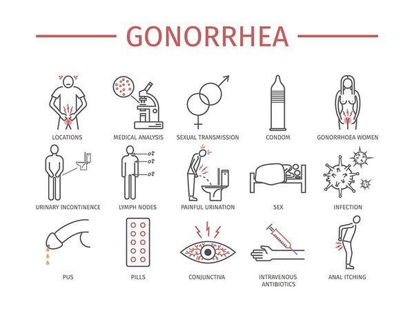 Gonorrhea