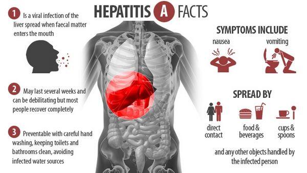 Hepatitis A Hepatitis A