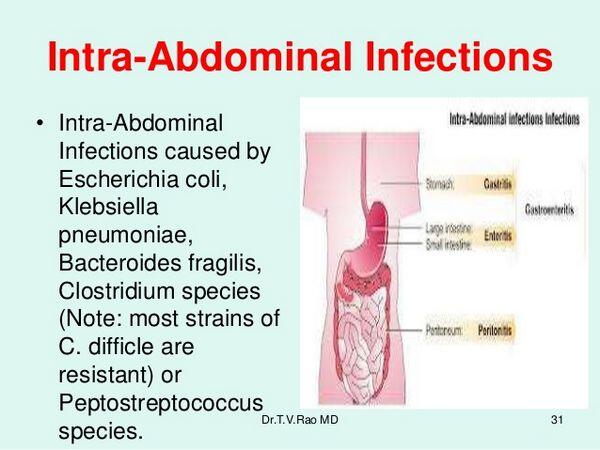 Intra-abdominal Infections