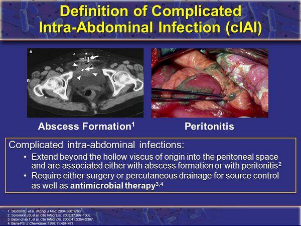 Intra-abdominal Infections - Intra-abdominal Infections - AntiinfectiveMeds.com Intra-abdominal Infections - Intra-abdominal Infections - AntiinfectiveMeds.com