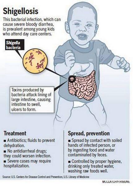 Shigellosis