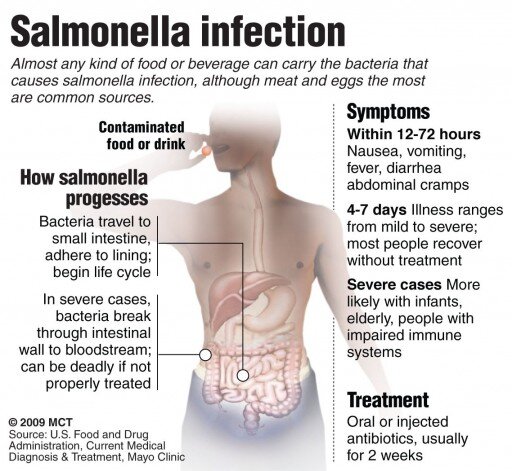 Salmonellosis