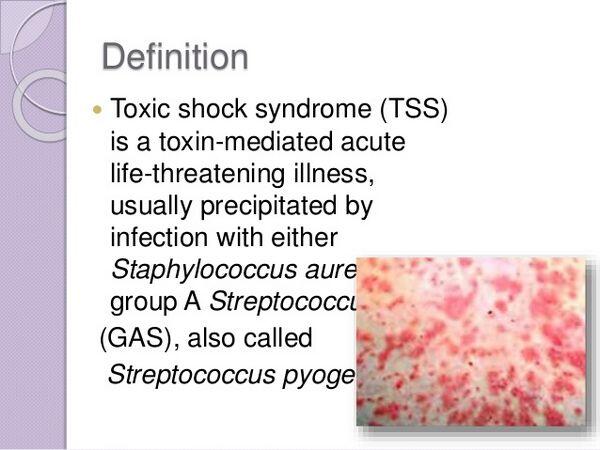 Toxic Shock in Children Toxic Shock in Children