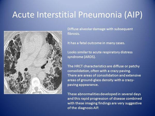 Acute Pneumonias