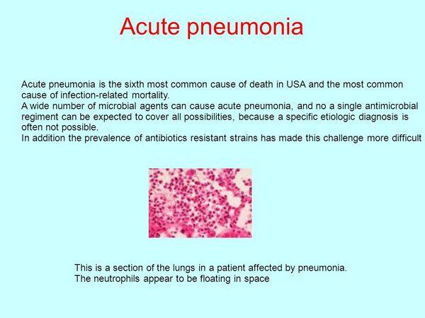 Acute Pneumonias