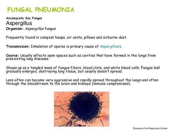 Fungal Pneumonias